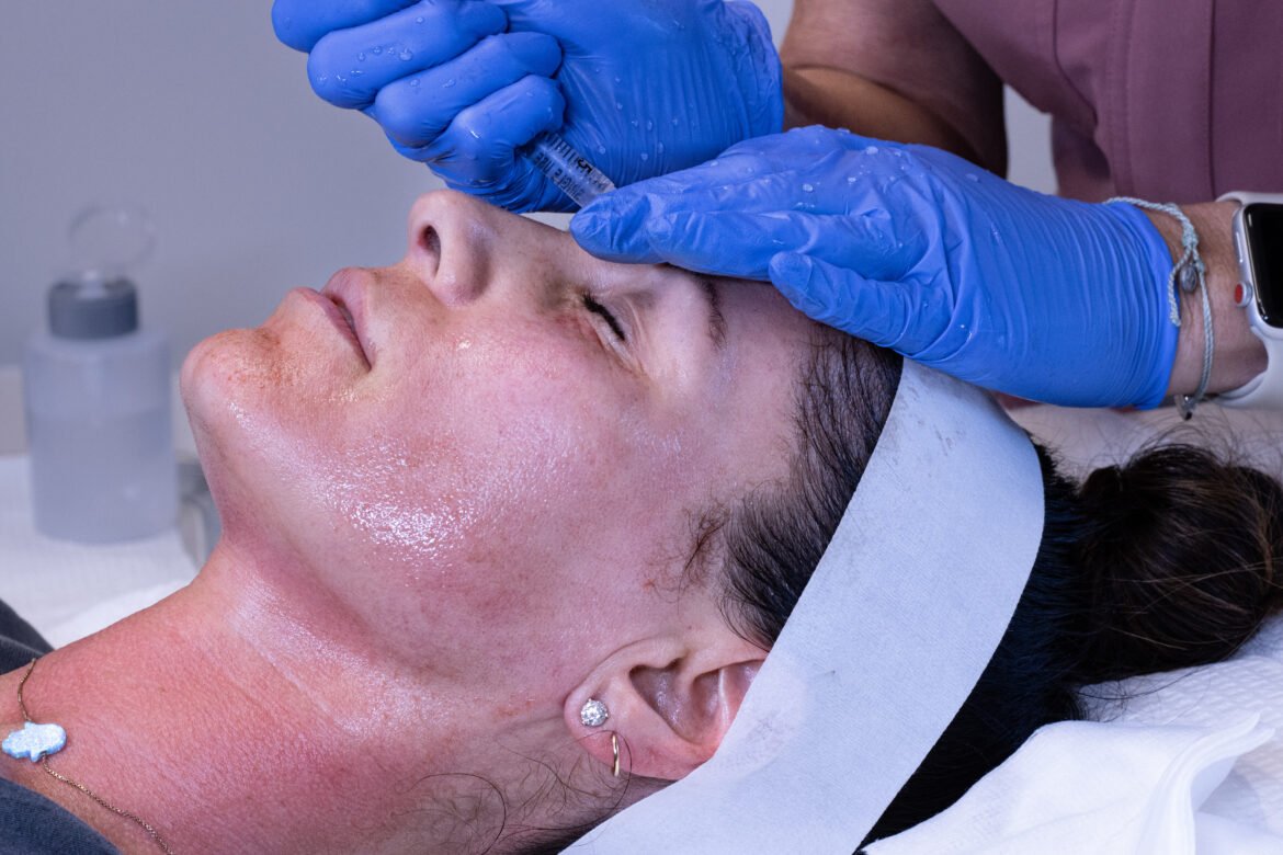 Cyrus Cosmetics Procedure